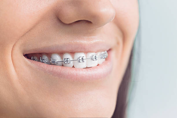 Best Dental Inlays and Onlays  in Manti, UT